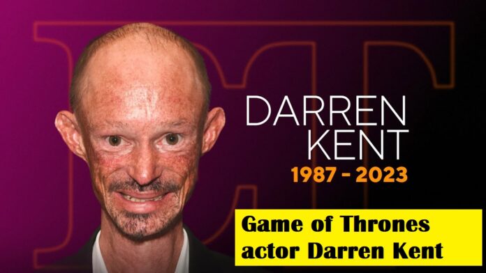 Game of Thrones actor Darren Kent